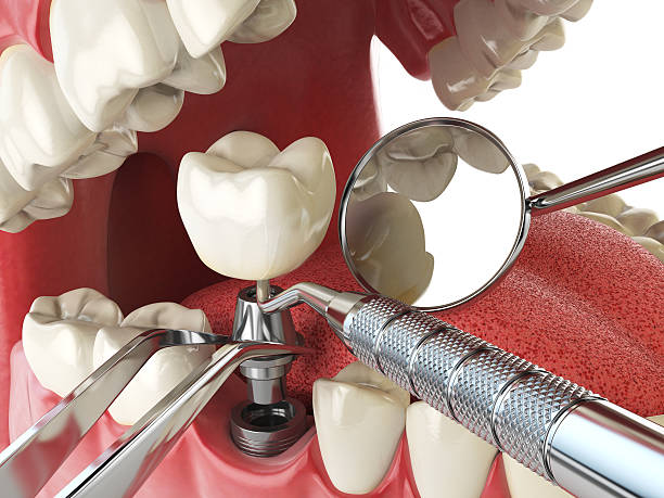 Best Emergency Gum Treatment in Vashon, WA